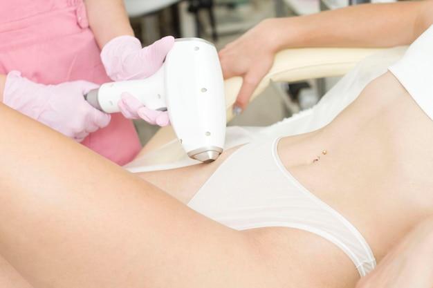 laser dark spot removal bikini area