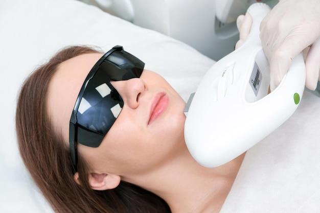 laser hair removal chin women