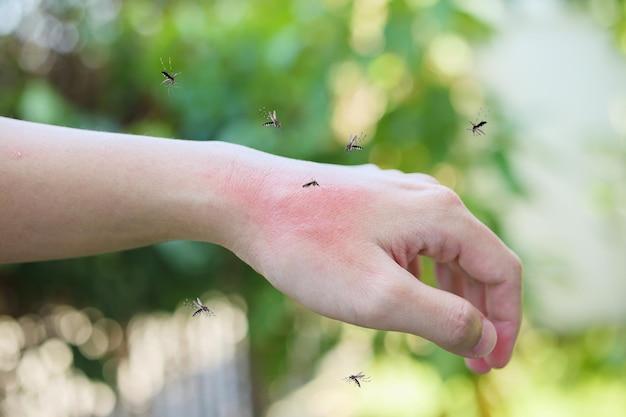 how to tell a spider bite from a mosquito bite