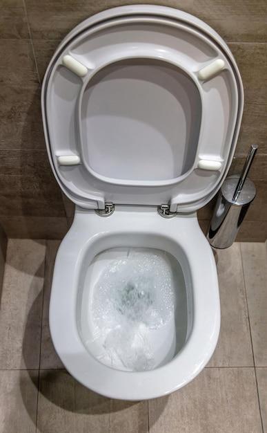 water in toilet bowl low