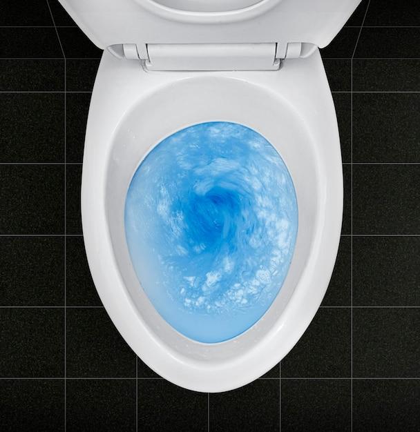 water in toilet bowl low