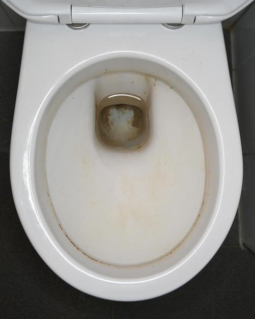 Is Your Toilet Bowl Water Level Too Low? Here's What You Need to Know