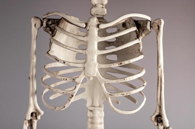 metal rib cage