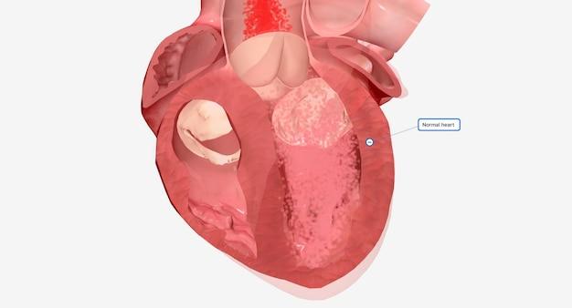 Understanding Average Settlements for Soft Tissue Injuries in Car ...