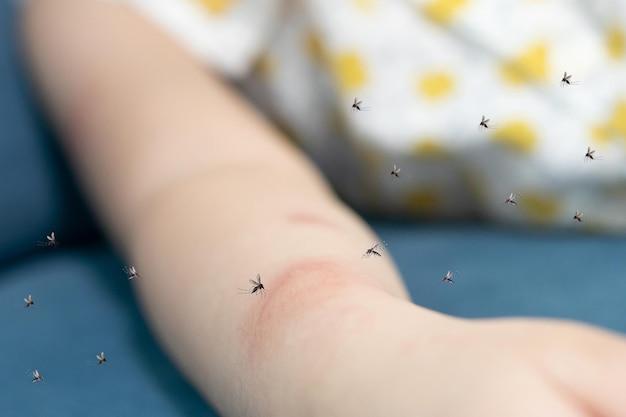 how to tell spider bite from mosquito