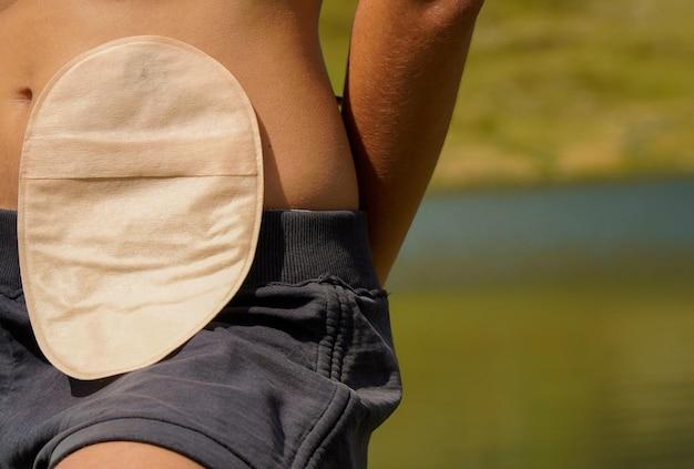 ostomy bag covers