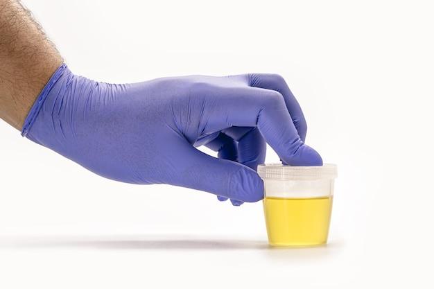 fake pee drug test