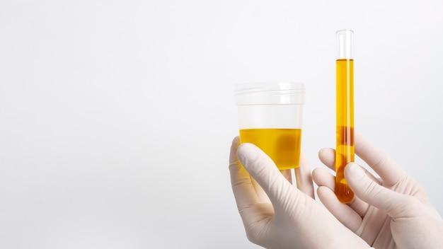 fake pee drug test