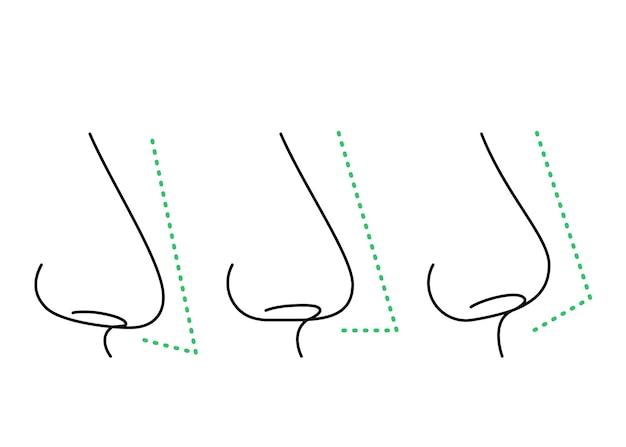 Todo Lo Que Necesitas Saber Sobre Los Diferentes Tipos De Nariz Oatuu
