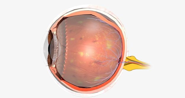 Can you have glaucoma without being a diabetic? 