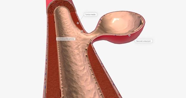  Does Silicone Expand In Heat 