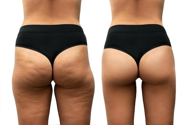 How Long Does It Take To Tone Your Butt 