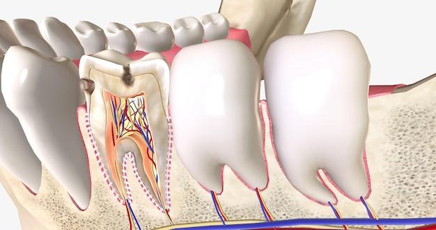  How To Fill Tiny Cavity On Front Tooth Diy 