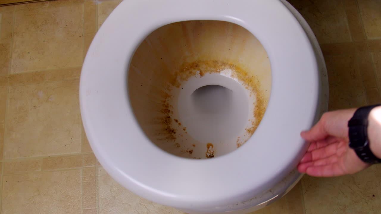 How To Get Poop Stains Out Of Toilet Seat