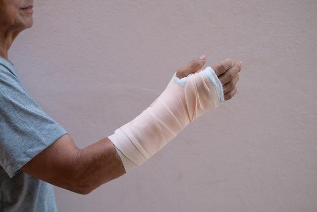  Is There An Alternative To A Plaster Cast 