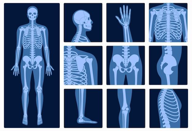 What Is The Strongest Joint In The Body 